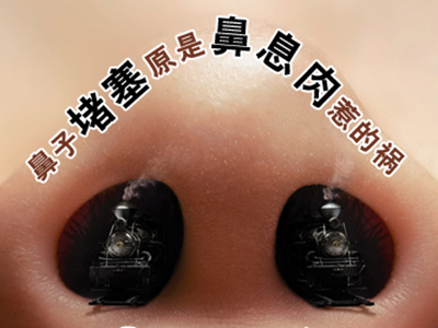 鼻息肉的危害有哪些