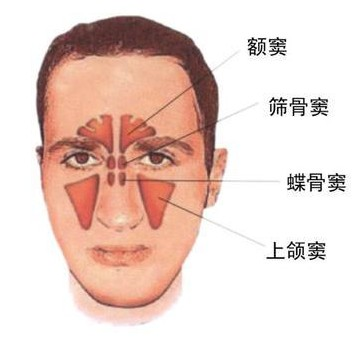 哪种治疗鼻窦炎的方法比较好