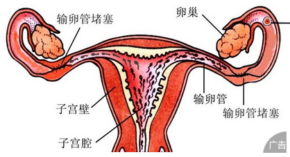 子宫性不孕都有什么原因造成的