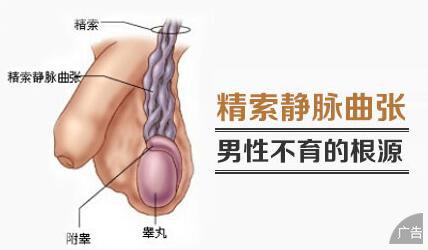 精索静脉曲张的危害性你知道哪些