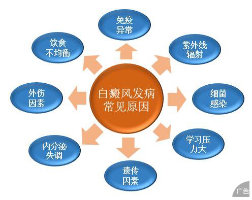 怎么判断是不是白癜风