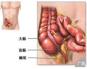 阑尾炎患者的常见危害有什么