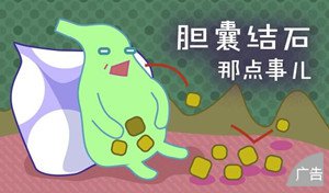 胆结石的症状是什么样的