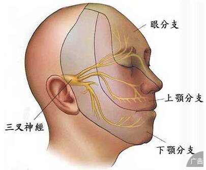 三叉神经痛的危害是怎么样的