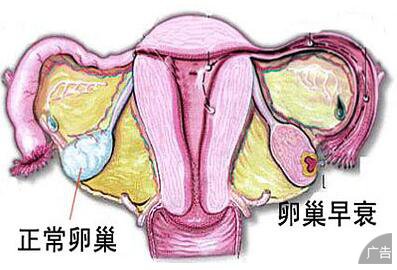 卵巢性不孕都有哪些症状表现呢