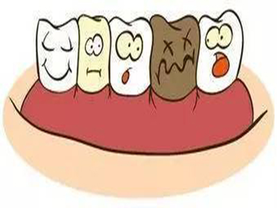 牙周炎有哪些治疗方法