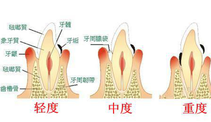 口腔常见的疾病有哪几种